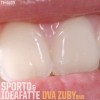 Sporto - Dva zuby remix by IdeaFatte