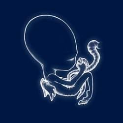 Sigur Rós - Ágætis Byrjun