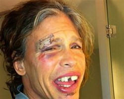 Steven Tyler bez zubu